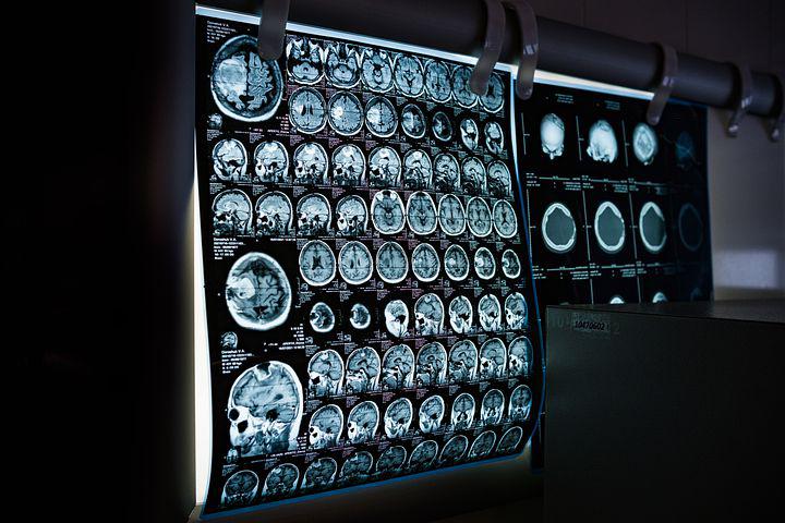 De MRI scan gebruiken om te weten te komen met welke stofjes ze in voedsel de juiste kick bij u kunnen oproepen zodat u verslaafd raakt en bij hen blijft kopen